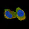 ICC of Anti-CNP Antibody AMAb91072