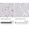 IHC of Anti-ADAR Antibody AMAb90535