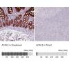 IHC of Anti-ACSL5 Antibody AMAb90634