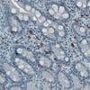 IHC of Anti-KIT Antibody AMAb90901