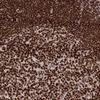 IHC of Anti-PARP1 Antibody AMAb90959