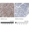 IHC of Anti-ABCD3 Antibody AMAb90995
