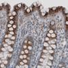 IHC of Anti-ACAA1 Antibody AMAb91020