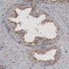 IHC of Anti-ACAA1 Antibody AMAb91022