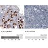 IHC of Anti-ACE2 Antibody AMAb91259