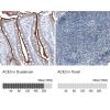 IHC of Anti-ACE2 Antibody AMAb91262
