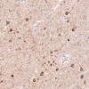 IHC of Anti-CDKL5 Antibody AMAb91323