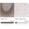 IHC of Anti-NFKB2 Antibody AMAb91511