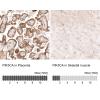 IHC of Anti-PIK3CA Antibody AMAb91514