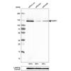 WB of Anti-PARP1 Antibody AMAb90959