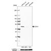 WB of Anti-ACAA1 Antibody AMAb91020