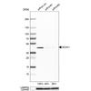 WB of Anti-ACAA1 Antibody AMAb91022
