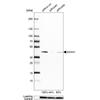WB of Anti-ACAA1 Antibody AMAb91023