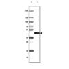 WB of Anti-CNP Antibody AMAb91072