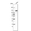 WB of Anti-ACE2 Antibody AMAb91259