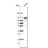WB of Anti-ACE2 Antibody AMAb91262