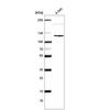WB of Anti-CDKL5 Antibody AMAb91323