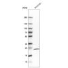 WB of Anti-RGS5 Antibody AMAb91377