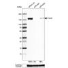 WB of Anti-ITGA5 Antibody AMAb91449