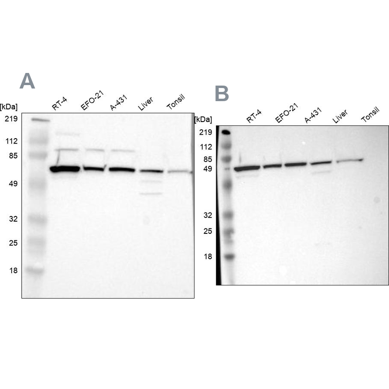 Western blot analysis using Anti-CKAP4 antibody HPA001225 (A) shows similar pattern to independent antibody HPA000278 (B).