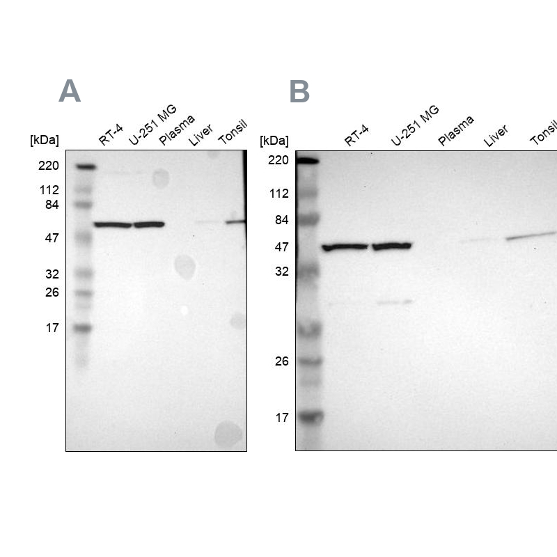 Western blot analysis using Anti-CCT5 antibody HPA002238 (A) shows similar pattern to independent antibody HPA005958 (B).