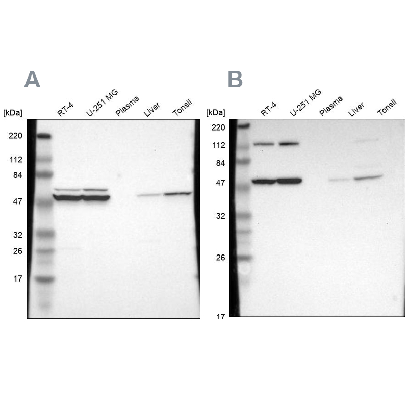 Western blot analysis using Anti-CCT2 antibody HPA003197 (A) shows similar pattern to independent antibody HPA003198 (B).