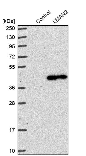 Western blot analysis in control (vector only transfected HEK293T lysate) and LMAN2 over-expression lysate (Co-expressed with a C-terminal myc-DDK tag (~3.1 kDa) in mammalian HEK293T cells, LY416403). Western blot analysis in control (vector only transfected HEK293T lysate) and LMAN2 over-expression lysate (Co-expressed with a C-terminal myc-DDK tag (~3.1 kDa) in mammalian HEK293T cells, LY416403).