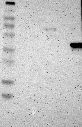 Lane 1: Marker [kDa] 230, 130, 95, 72, 56, 36, 28, 17, 11 | Lane 2: RT4 | Lane 3: U-251 MG | Lane 4: Human Plasma | Lane 5: Liver | Lane 6: Tonsil