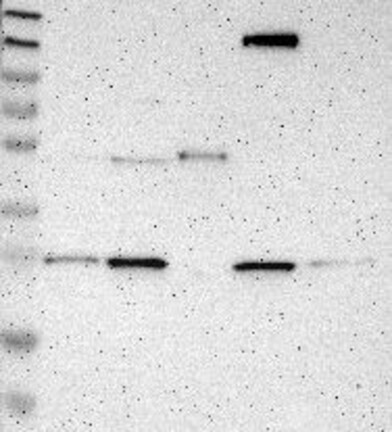 Lane 1: Marker [kDa] 230, 130, 95, 72, 56, 36, 28, 17, 11 | Lane 2: RT4 | Lane 3: U-251 MG | Lane 4: Human Plasma | Lane 5: Liver | Lane 6: Tonsil