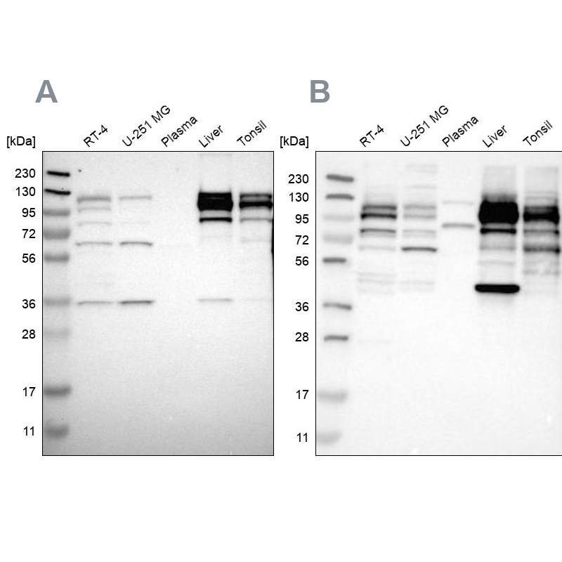 Western blot analysis using Anti-RRBP1 antibody HPA011924 (A) shows similar pattern to independent antibody HPA009026 (B).
