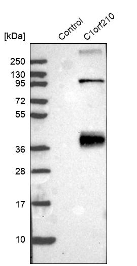 Western blot analysis in control (vector only transfected HEK293T lysate) and C1orf210 over-expression lysate (Co-expressed with a C-terminal myc-DDK tag (~3.1 kDa) in mammalian HEK293T cells, LY405533). Western blot analysis in control (vector only transfected HEK293T lysate) and C1orf210 over-expression lysate (Co-expressed with a C-terminal myc-DDK tag (~3.1 kDa) in mammalian HEK293T cells, LY405533).