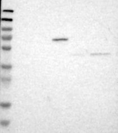 Lane 1: Marker [kDa] 230, 130, 95, 72, 56, 36, 28, 17, 11 | Lane 2: RT4 | Lane 3: U-251 MG | Lane 4: Human Plasma | Lane 5: Liver | Lane 6: Tonsil