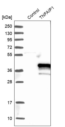 Western blot analysis in control (vector only transfected HEK293T lysate) and TNFAIP1 over-expression lysate (Co-expressed with a C-terminal myc-DDK tag (~3.1 kDa) in mammalian HEK293T cells, LY412070). Western blot analysis in control (vector only transfected HEK293T lysate) and TNFAIP1 over-expression lysate (Co-expressed with a C-terminal myc-DDK tag (~3.1 kDa) in mammalian HEK293T cells, LY412070).