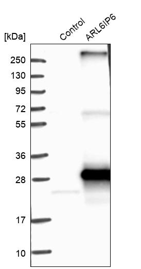 Western blot analysis in control (vector only transfected HEK293T lysate) and ARL6IP6 over-expression lysate (Co-expressed with a C-terminal myc-DDK tag (~3.1 kDa) in mammalian HEK293T cells, LY407476). Western blot analysis in control (vector only transfected HEK293T lysate) and ARL6IP6 over-expression lysate (Co-expressed with a C-terminal myc-DDK tag (~3.1 kDa) in mammalian HEK293T cells, LY407476).