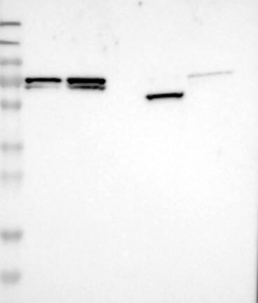 Lane 1: Marker [kDa] 230, 130, 95, 72, 56, 36, 28, 17, 11 | Lane 2: RT4 | Lane 3: U-251 MG | Lane 4: Human Plasma | Lane 5: Liver | Lane 6: Tonsil