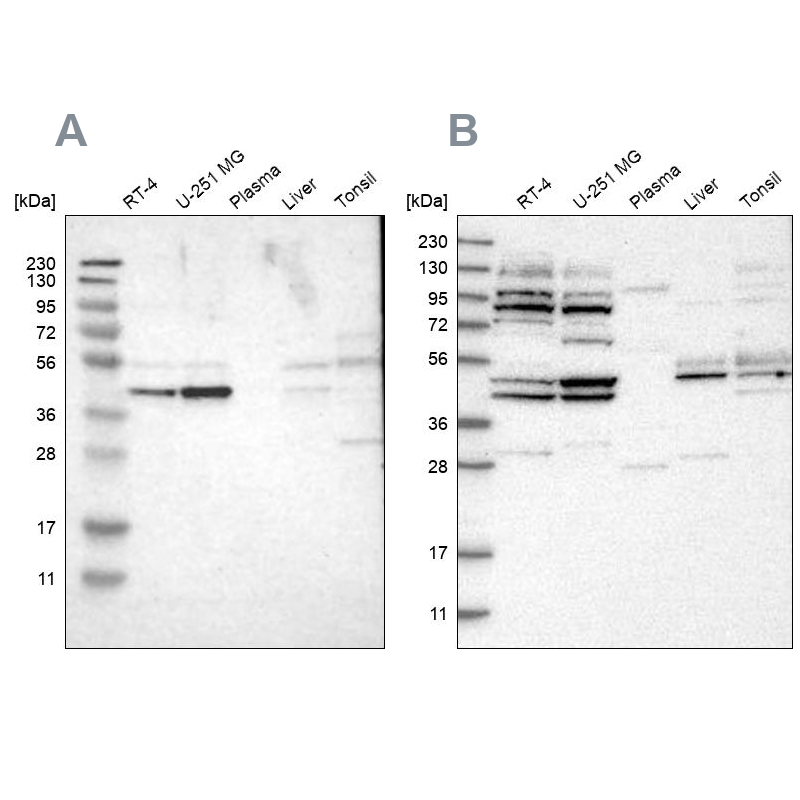 Western blot analysis using Anti-WDR53 antibody HPA016420 (A) shows similar pattern to independent antibody HPA019332 (B). Western blot analysis using Anti-WDR53 antibody HPA016420 (A) shows similar pattern to independent antibody HPA019332 (B).