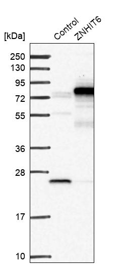 Western blot analysis in control (vector only transfected HEK293T lysate) and ZNHIT6 over-expression lysate (Co-expressed with a C-terminal myc-DDK tag (~3.1 kDa) in mammalian HEK293T cells, LY413413).