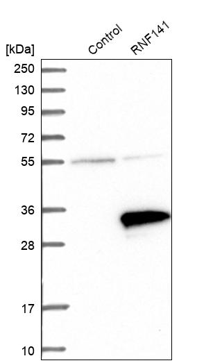 Western blot analysis in control (vector only transfected HEK293T lysate) and RNF141 over-expression lysate (Co-expressed with a C-terminal myc-DDK tag (~3.1 kDa) in mammalian HEK293T cells, LY414010). Western blot analysis in control (vector only transfected HEK293T lysate) and RNF141 over-expression lysate (Co-expressed with a C-terminal myc-DDK tag (~3.1 kDa) in mammalian HEK293T cells, LY414010).