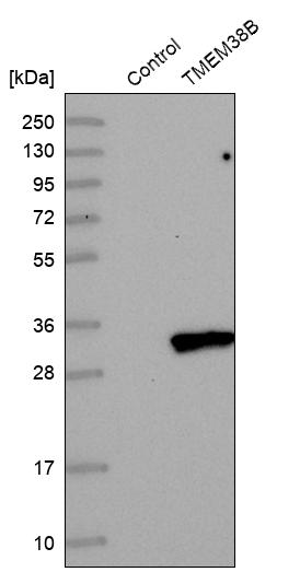 Western blot analysis in control (vector only transfected HEK293T lysate) and TMEM38B over-expression lysate (Co-expressed with a C-terminal myc-DDK tag (~3.1 kDa) in mammalian HEK293T cells, LY413299). Western blot analysis in control (vector only transfected HEK293T lysate) and TMEM38B over-expression lysate (Co-expressed with a C-terminal myc-DDK tag (~3.1 kDa) in mammalian HEK293T cells, LY413299).