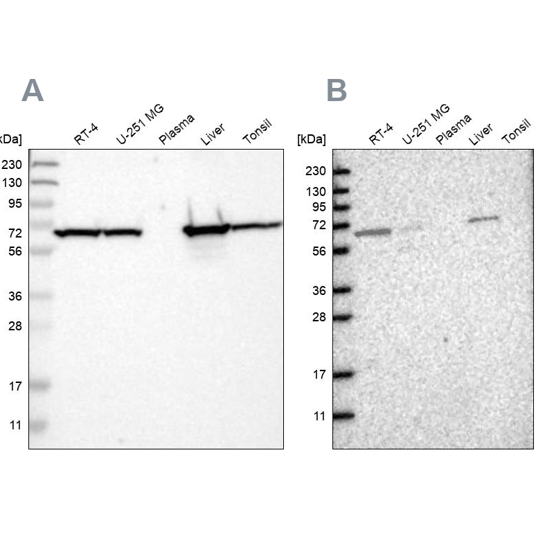 Western blot analysis using Anti-ACADVL antibody HPA019006 (A) shows similar pattern to independent antibody HPA020595 (B).