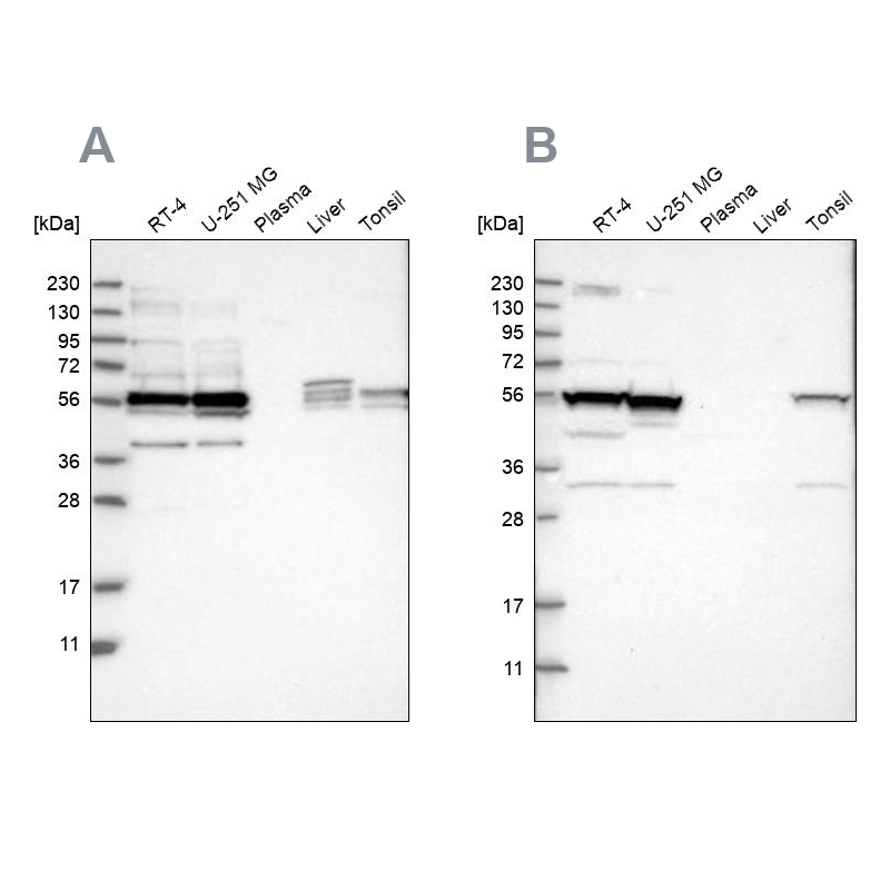 Western blot analysis using Anti-SMU1 antibody HPA019228 (A) shows similar pattern to independent antibody HPA019708 (B). Western blot analysis using Anti-SMU1 antibody HPA019228 (A) shows similar pattern to independent antibody HPA019708 (B).