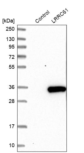 Western blot analysis in control (vector only transfected HEK293T lysate) and LRRC61 over-expression lysate (Co-expressed with a C-terminal myc-DDK tag (~3.1 kDa) in mammalian HEK293T cells, LY411423). Western blot analysis in control (vector only transfected HEK293T lysate) and LRRC61 over-expression lysate (Co-expressed with a C-terminal myc-DDK tag (~3.1 kDa) in mammalian HEK293T cells, LY411423).