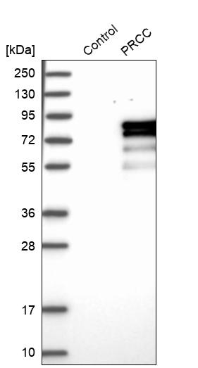 Western blot analysis in control (vector only transfected HEK293T lysate) and PRCC over-expression lysate (Co-expressed with a C-terminal myc-DDK tag (~3.1 kDa) in mammalian HEK293T cells, LY416956). Western blot analysis in control (vector only transfected HEK293T lysate) and PRCC over-expression lysate (Co-expressed with a C-terminal myc-DDK tag (~3.1 kDa) in mammalian HEK293T cells, LY416956).