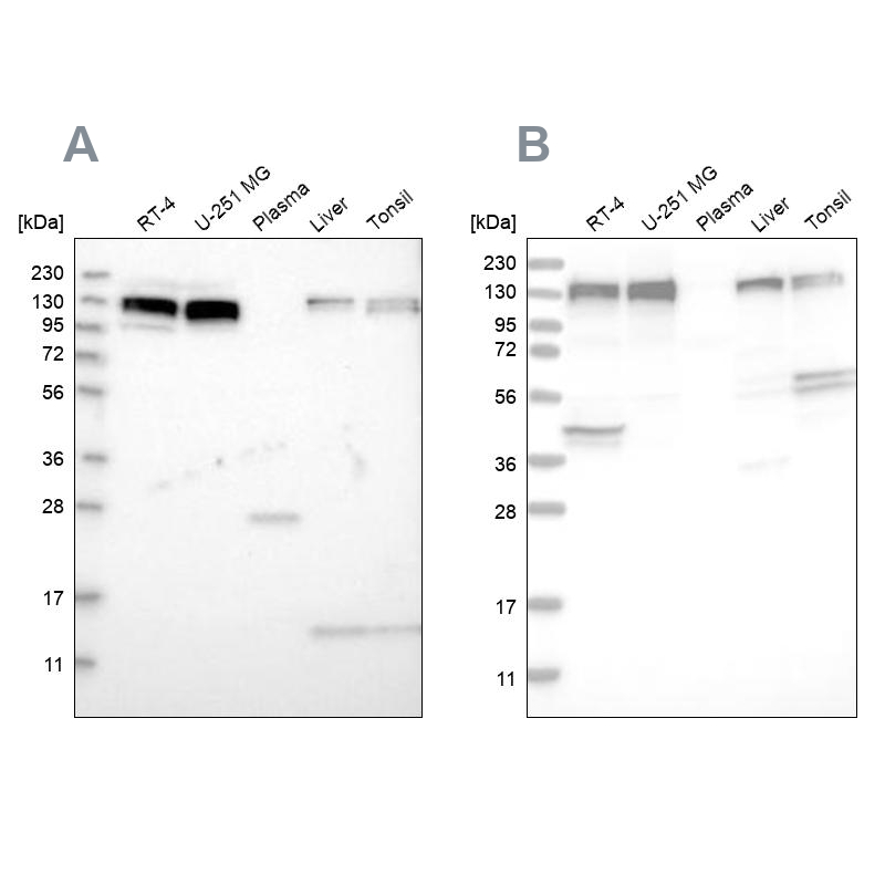 Western blot analysis using Anti-ERC1 antibody HPA019513 (A) shows similar pattern to independent antibody HPA019523 (B).