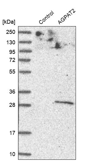 Western blot analysis in control (vector only transfected HEK293T lysate) and AGPAT2 over-expression lysate (Co-expressed with a C-terminal myc-DDK tag (~3.1 kDa) in mammalian HEK293T cells, LY401930). Western blot analysis in control (vector only transfected HEK293T lysate) and AGPAT2 over-expression lysate (Co-expressed with a C-terminal myc-DDK tag (~3.1 kDa) in mammalian HEK293T cells, LY401930).