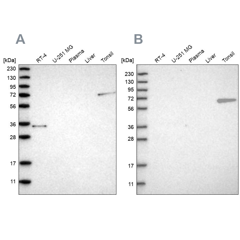 Western blot analysis using Anti-FNBP1 antibody HPA019691 (A) shows similar pattern to independent antibody HPA022119 (B).
