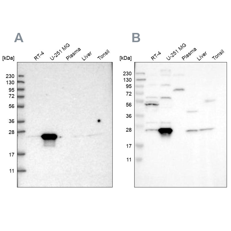 Western blot analysis using Anti-BAG2 antibody HPA019918 (A) shows similar pattern to independent antibody HPA018862 (B). Western blot analysis using Anti-BAG2 antibody HPA019918 (A) shows similar pattern to independent antibody HPA018862 (B).