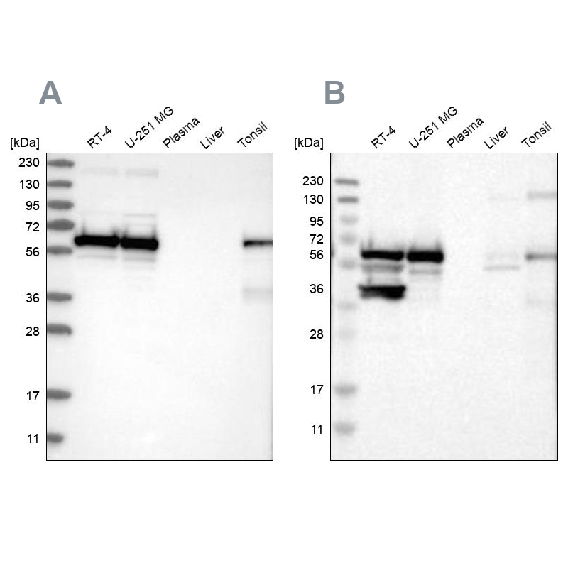 Western blot analysis using Anti-LUC7L3 antibody HPA020017 (A) shows similar pattern to independent antibody HPA018484 (B). Western blot analysis using Anti-LUC7L3 antibody HPA020017 (A) shows similar pattern to independent antibody HPA018484 (B).