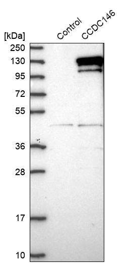 Western blot analysis in control (vector only transfected HEK293T lysate) and CCDC146 over-expression lysate (Co-expressed with a C-terminal myc-DDK tag (~3.1 kDa) in mammalian HEK293T cells, LY412242).