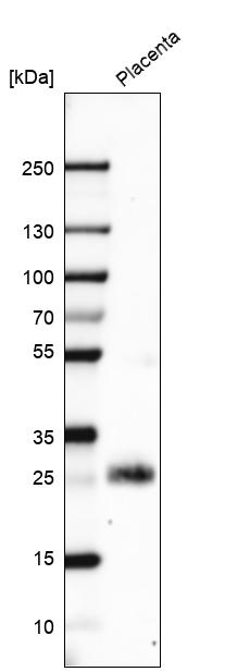 Western blot analysis in human placenta tissue.